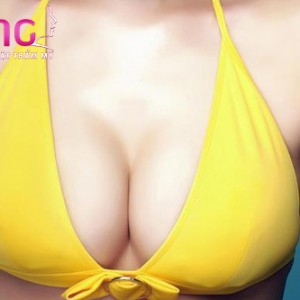 phau-thuat-nang-nguc-y-line-co-phai-nang-nguc-noi-soi-khong