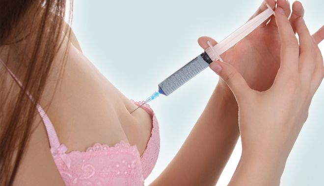 nang-nguc-khong-phau-thuat-5