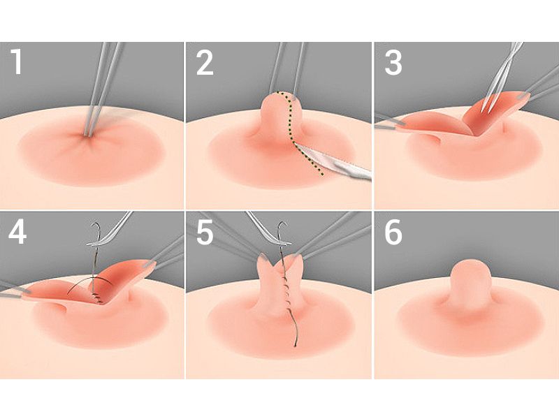 thu nho dau ti co lam mat cam giac